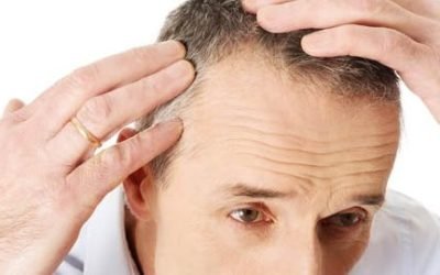 the benefits of hair transplant a guide to a new you