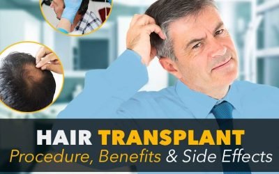 understanding hair transplant surgery benefits and risks